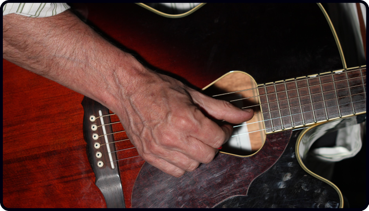 Playing guitar with 2024 thumb arthritis